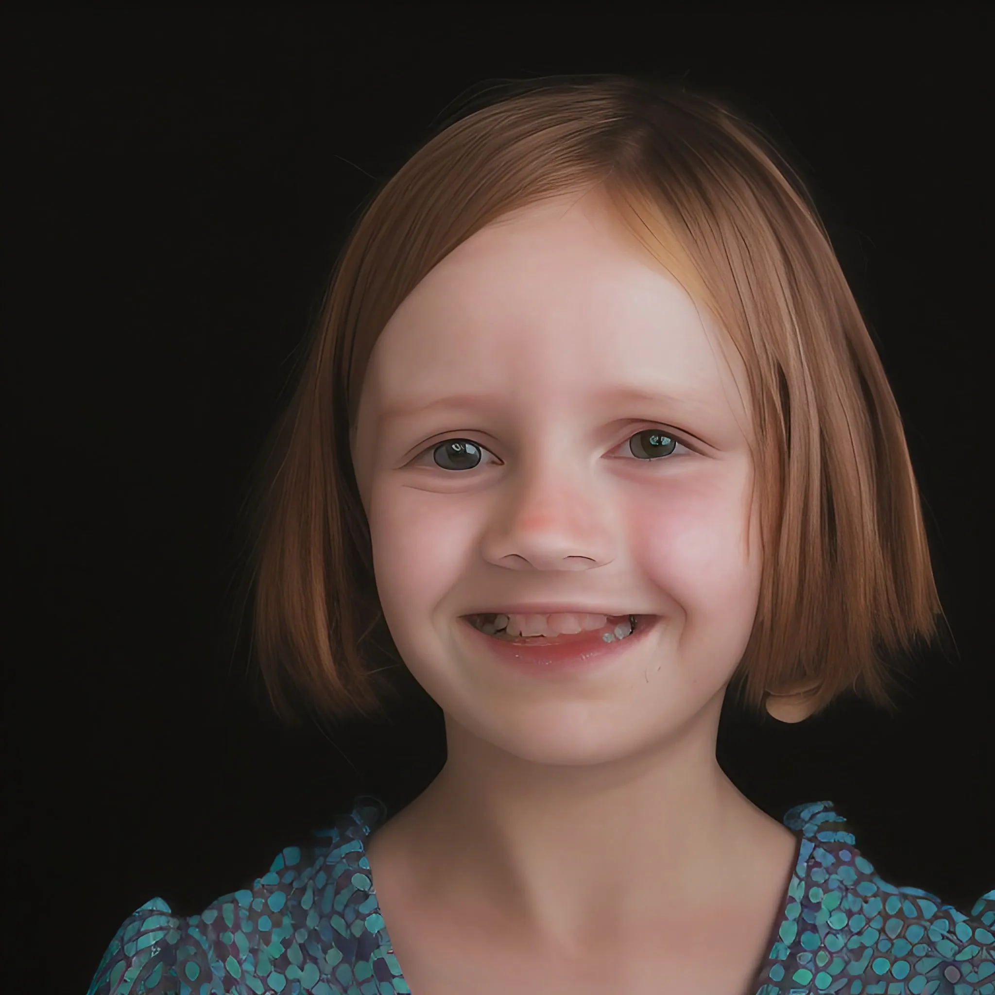 Fetal Alcohol Syndrome Disorder Picture Of Young Female Child